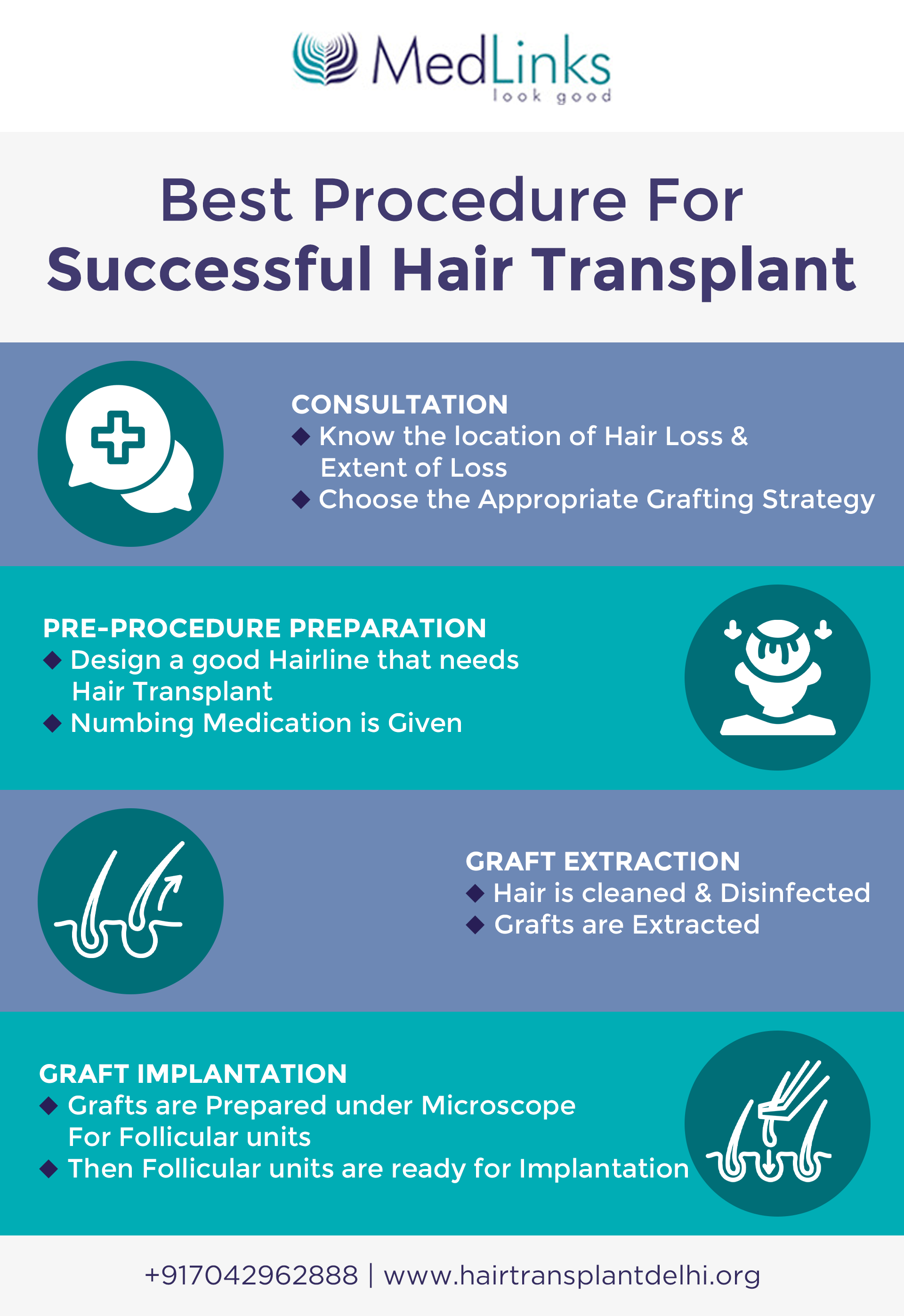 successful hair transplant